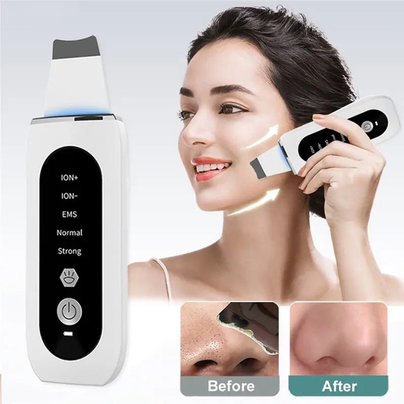 【DURABLE 】Ultrasonic Ance Pore Cleaner Shovel Cleanser Ultrasonic Skin Scrubber Peeling Blackhead Remover Deep Face Cleaning