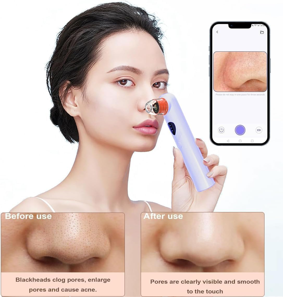 Blackhead Remover Vacuum,Blackhead Remover Tool with HD Camera & USB Charging - Pimple Extractor Vacuum,3 Stops & 4 Suction Heads Pore Extractor (Purple)
