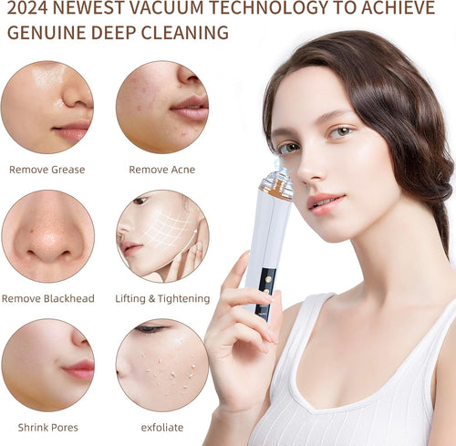 Blackhead Remover Pore Vacuum,Facial Pore Cleaner-6 Suction Power,3 Adjustable Suction Levels,Usb Rechargeable Blackhead Vacuum Kit Electric Acne Extractor Tool for Women & Men (White)