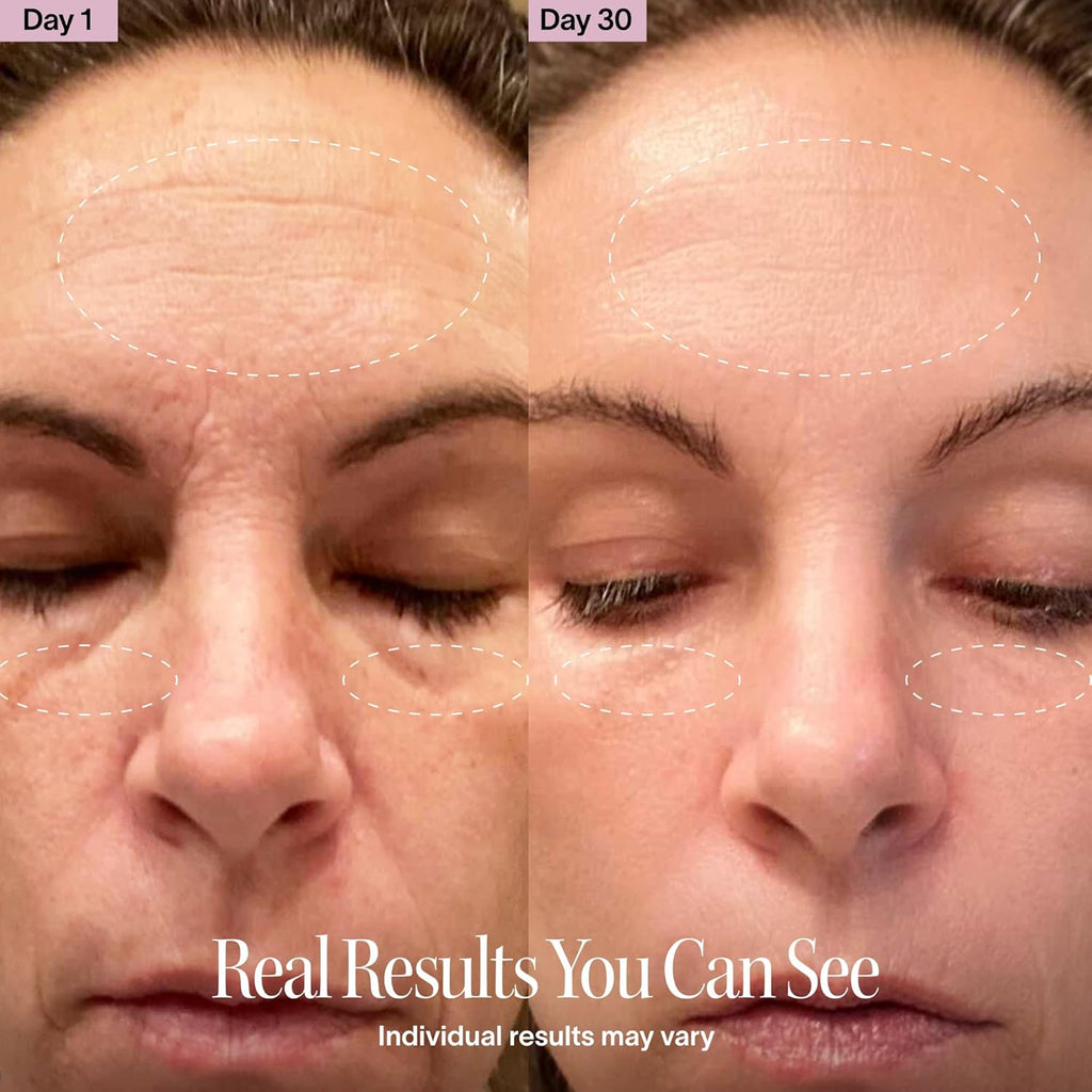Transform Your Skincare Routine with the 4-In-1 Red Light Therapy Wand and Activating Serum – Achieve Youthful Radiance for Face & Neck!