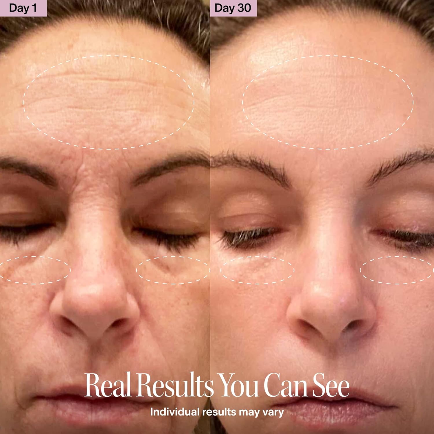Transform Your Skincare Routine with the 4-In-1 Red Light Therapy Wand and Activating Serum – Achieve Youthful Radiance for Face & Neck!