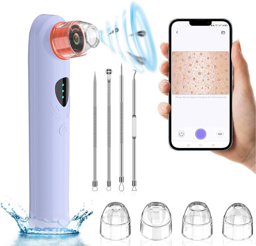 Blackhead Remover Vacuum,Blackhead Remover Tool with HD Camera & USB Charging - Pimple Extractor Vacuum,3 Stops & 4 Suction Heads Pore Extractor (Purple)