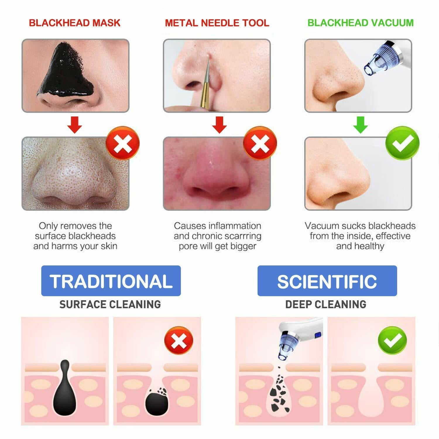 Brand New--Coofo Blackhead Remover Pore Vacuum Acne Whitehead Cleanser