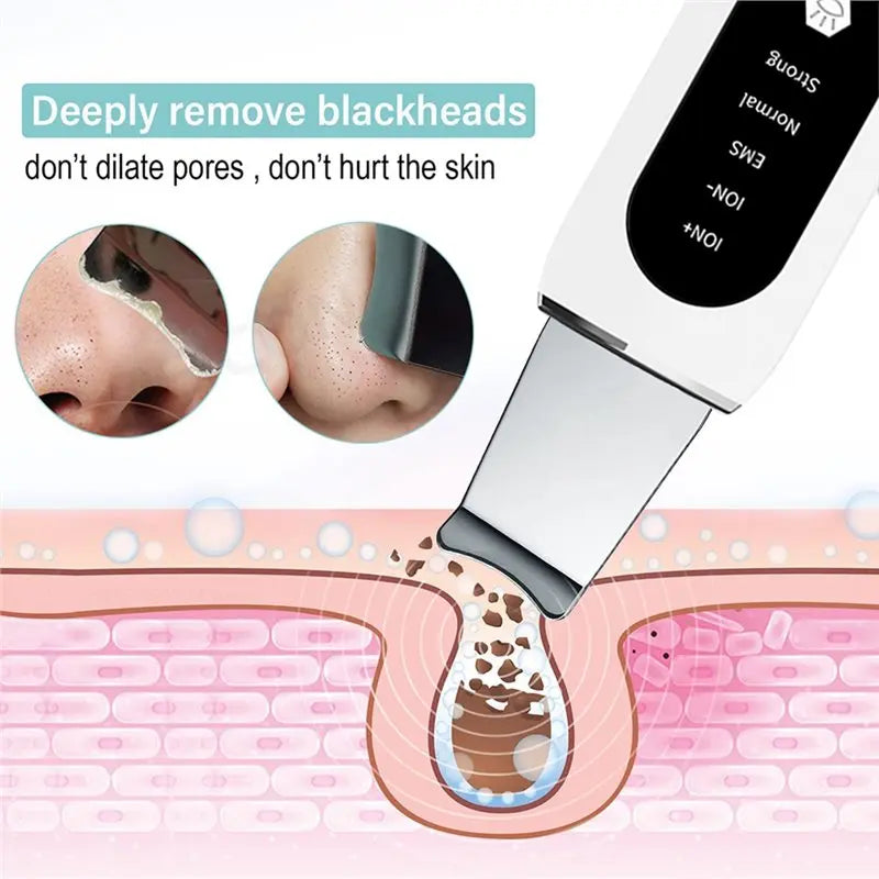 【DURABLE 】Ultrasonic Ance Pore Cleaner Shovel Cleanser Ultrasonic Skin Scrubber Peeling Blackhead Remover Deep Face Cleaning