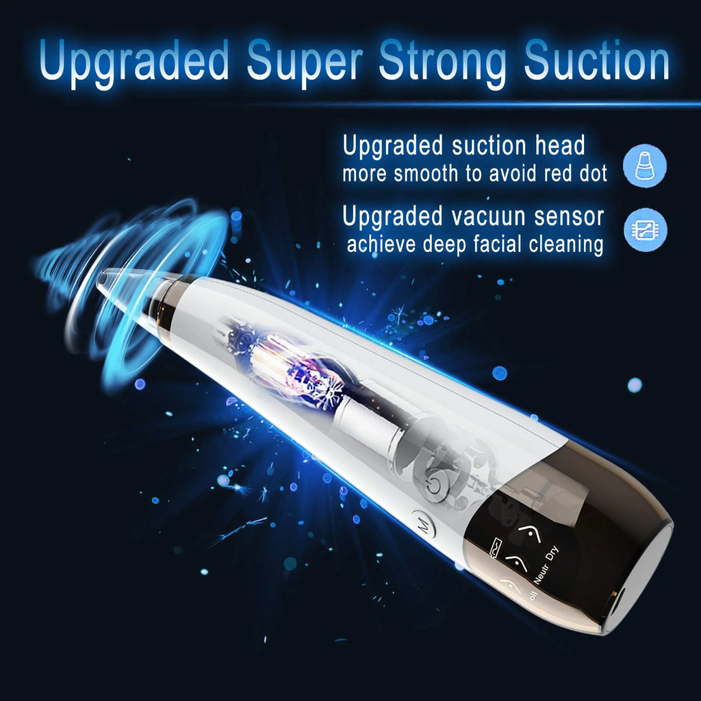 Blackhead Remover Pore Vacuum Cleaner - Electric USB Extractor with 5 Probes - White